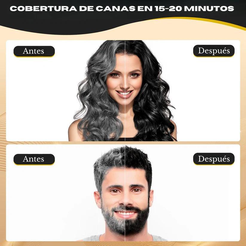 Champú